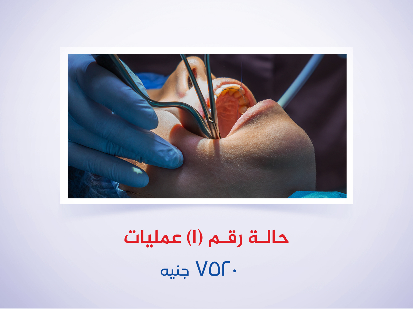حالة رقم (1) عمليات