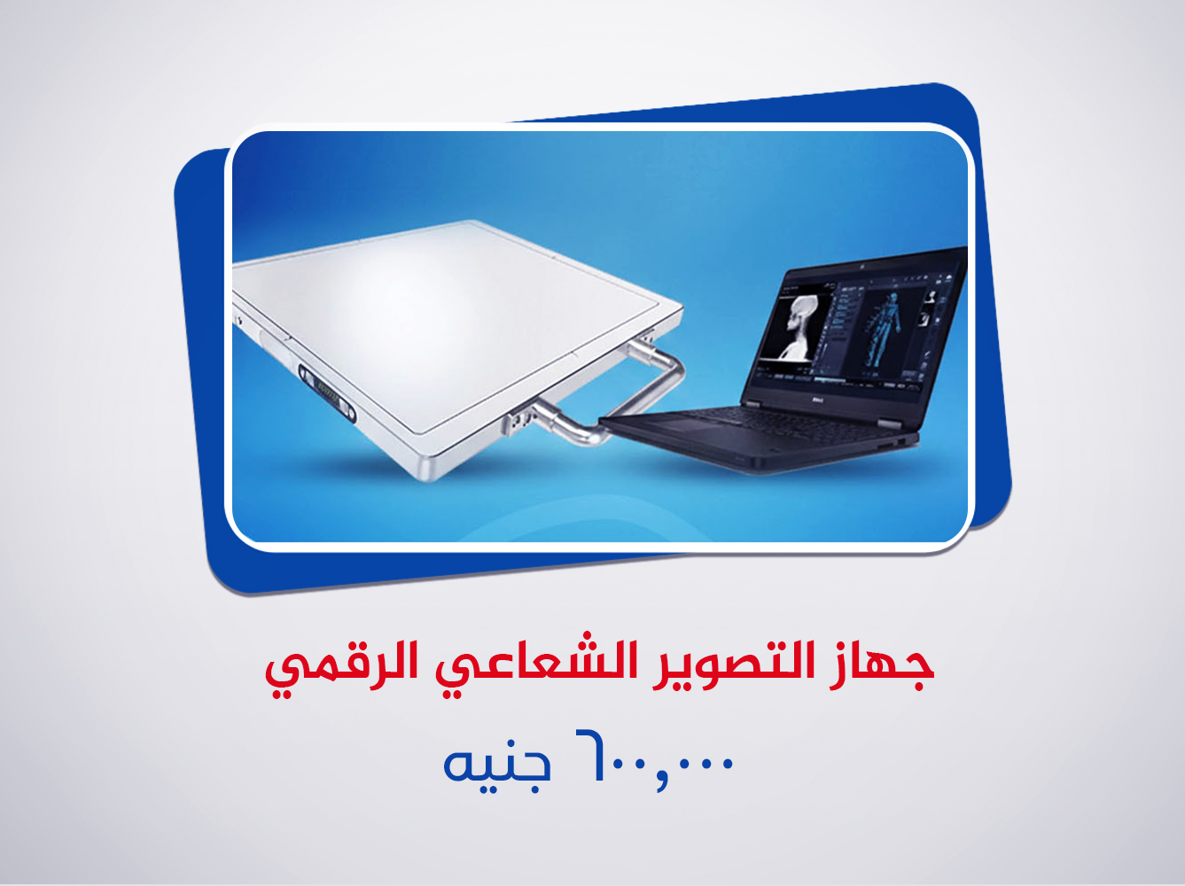 التصوير الشعاعي الرقمي (DR)