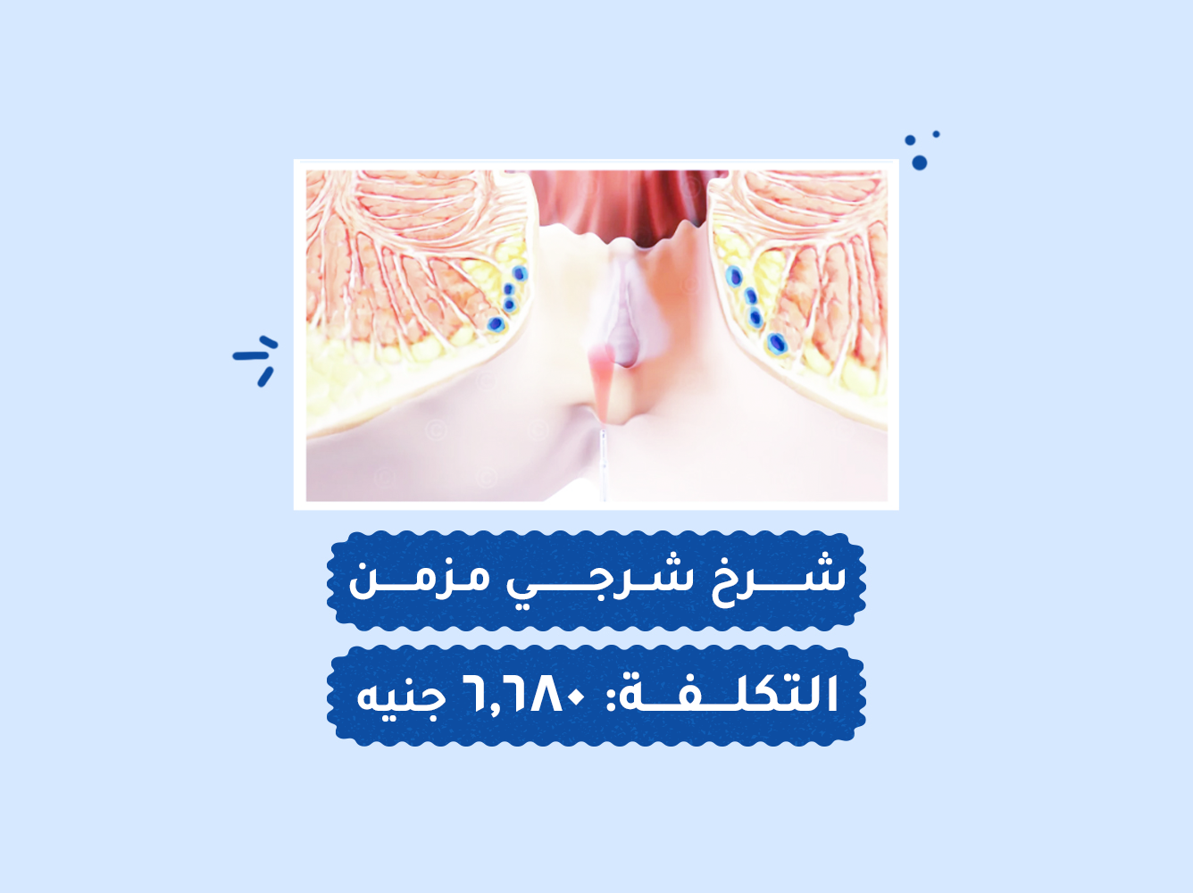 حالة رقم (100) عمليات
