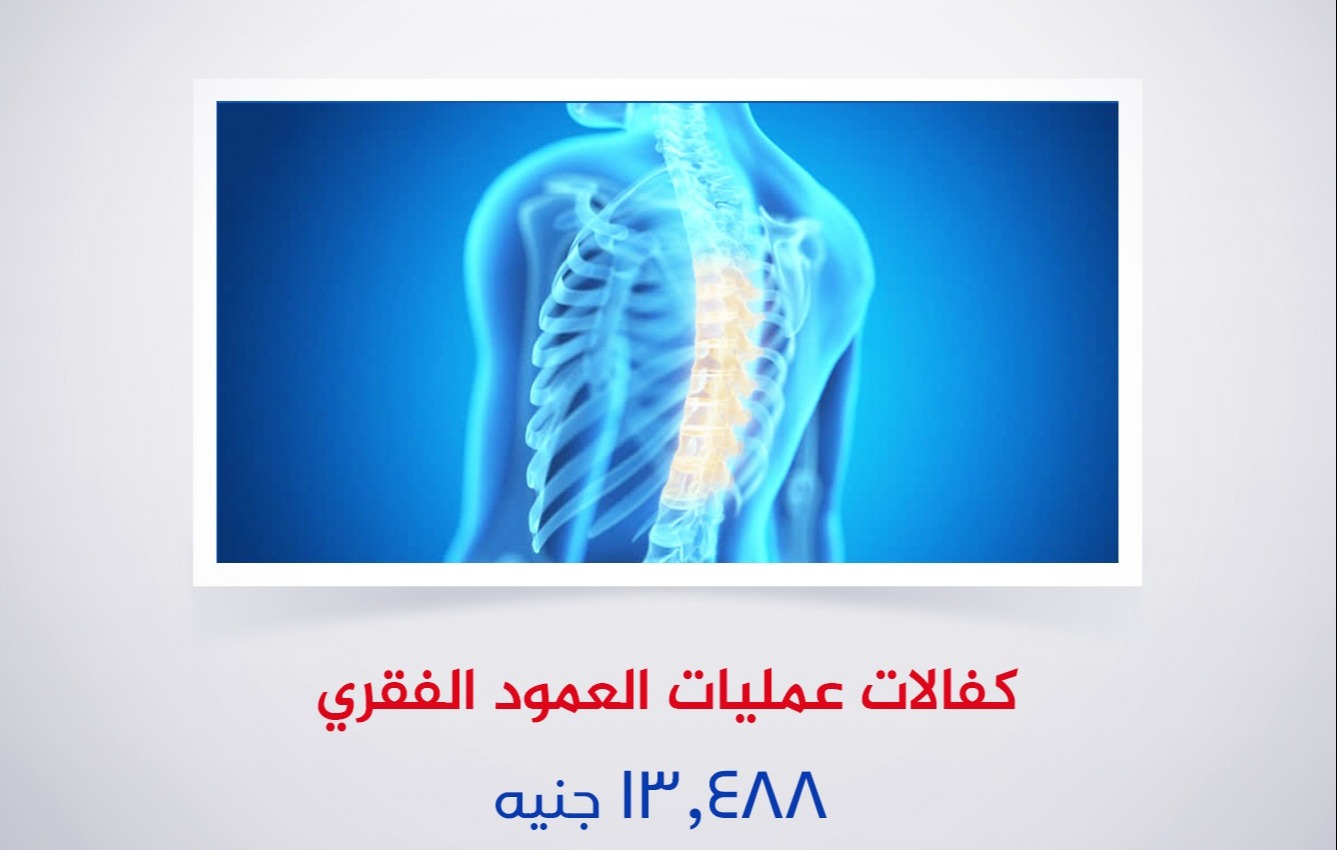 كفالات عمليات العمود الفقرى
