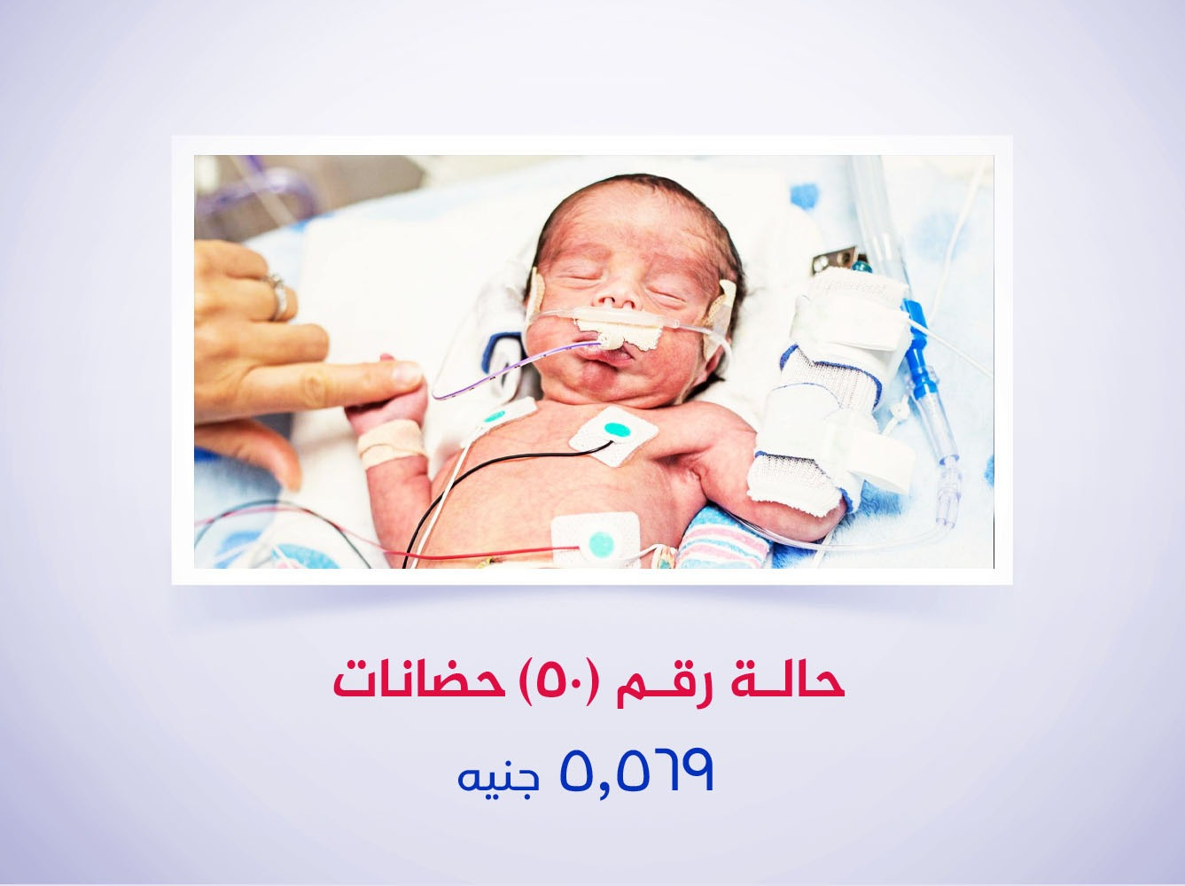حالة رقم (50) حضانات