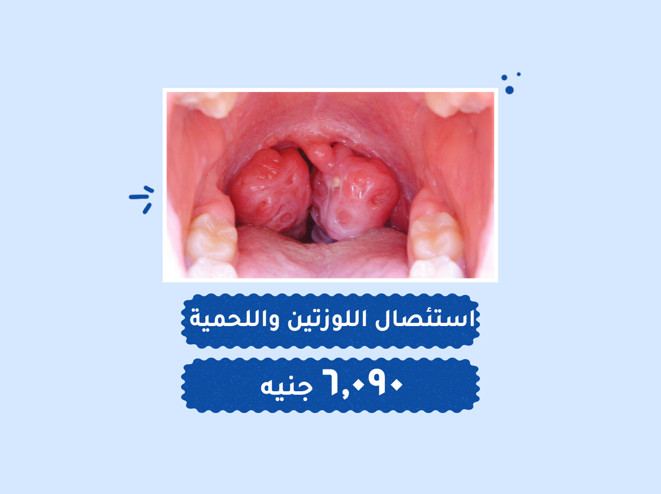 حالة رقم (118) – عمليات