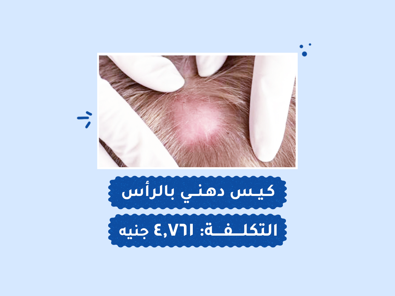 حالة رقم (97) عمليات
