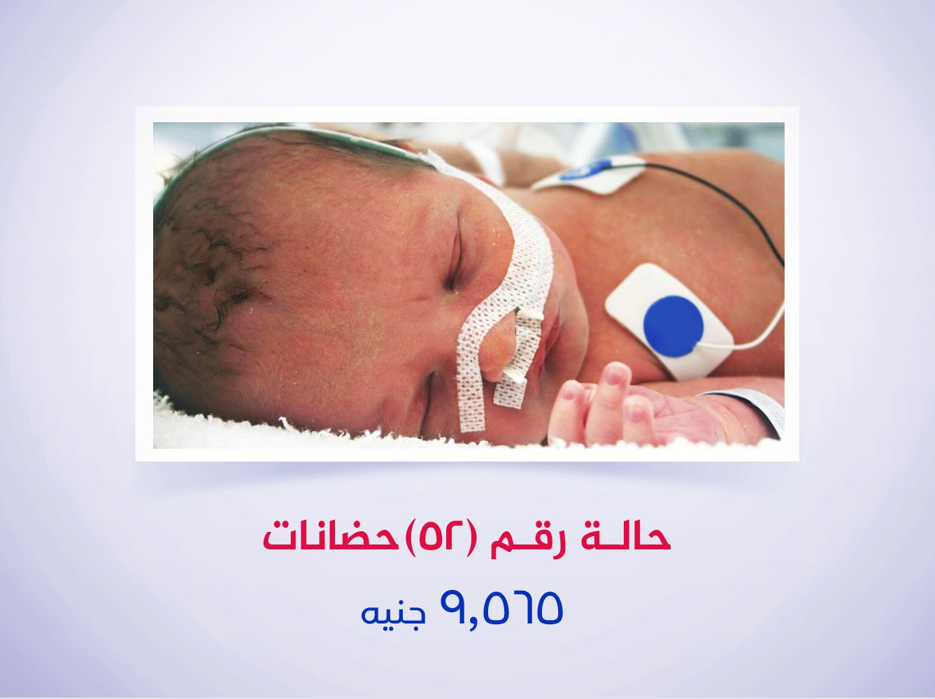 حالة رقم (52) حضانات