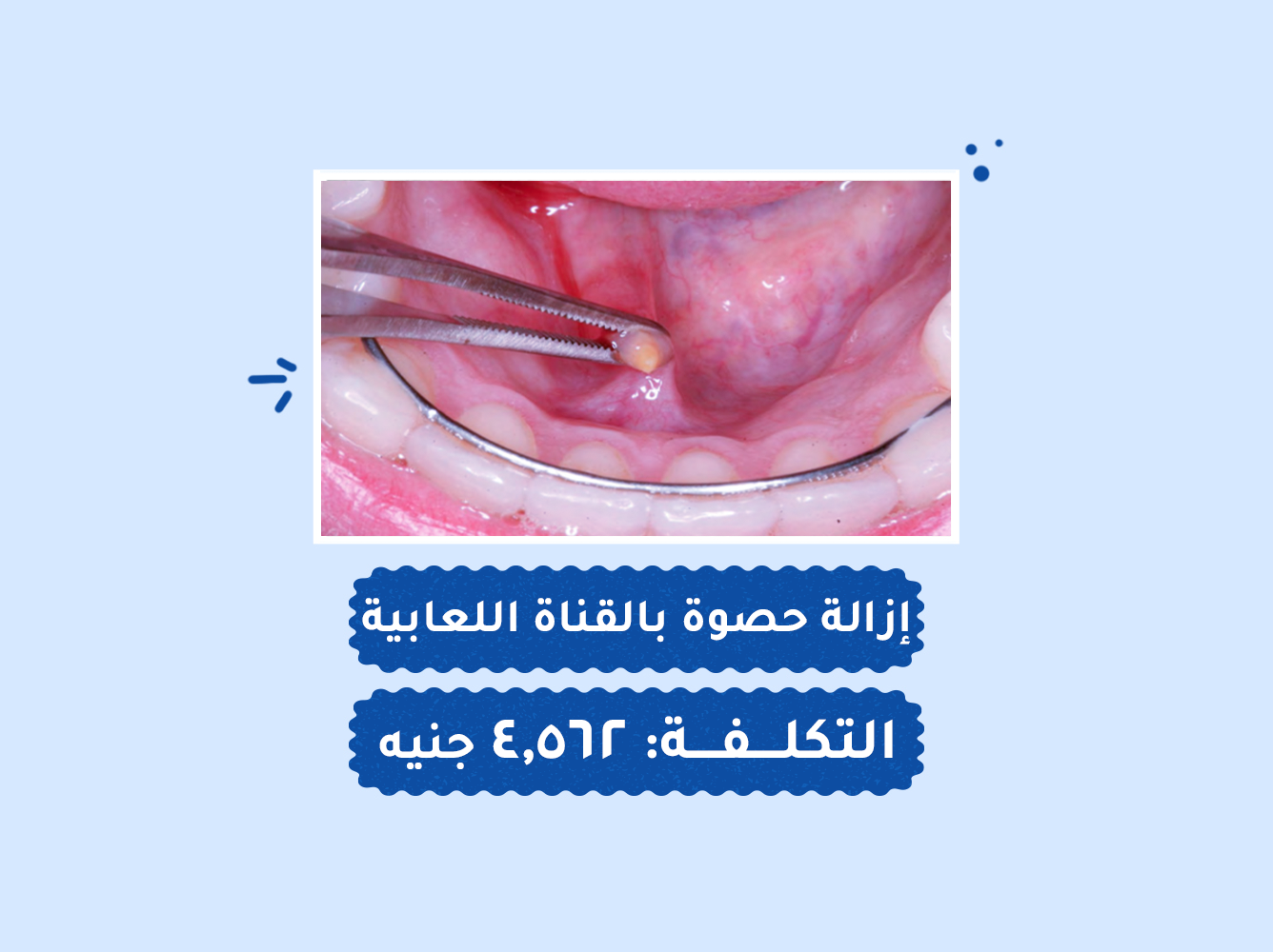 حالة رقم (89) عمليات
