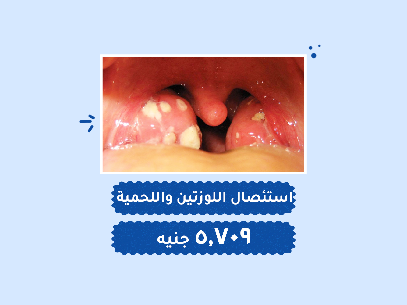 حالة رقم (124) – عمليات