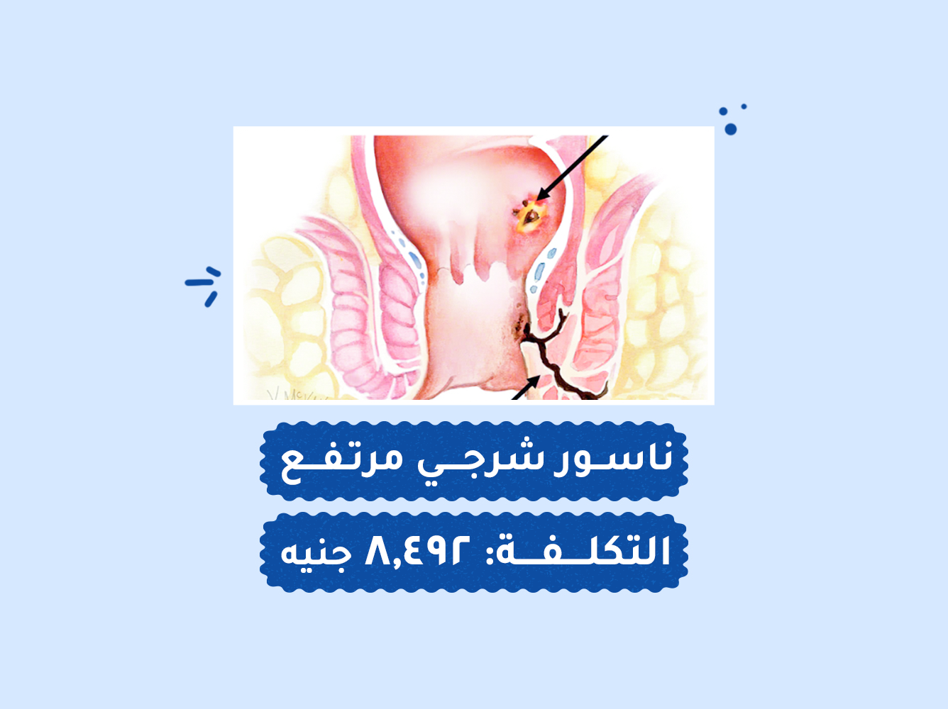 حالة رقم (97) عمليات