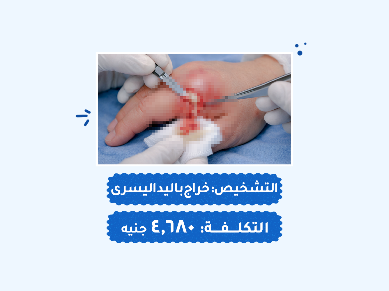 حالة رقم (56) عمليات