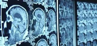 بدعمك مش هيكون عندنا انتظار أو تاجيل لعمل الاشعة، ساعدنا نكمل في تقديم خدمة صحية آدمية مجانية