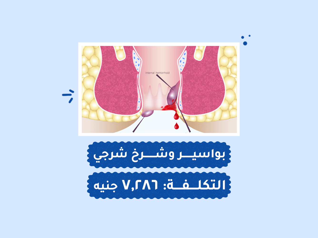 حالة رقم (95) عمليات