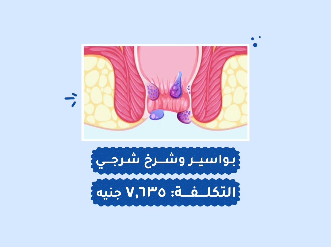 حالة رقم (91) عمليات