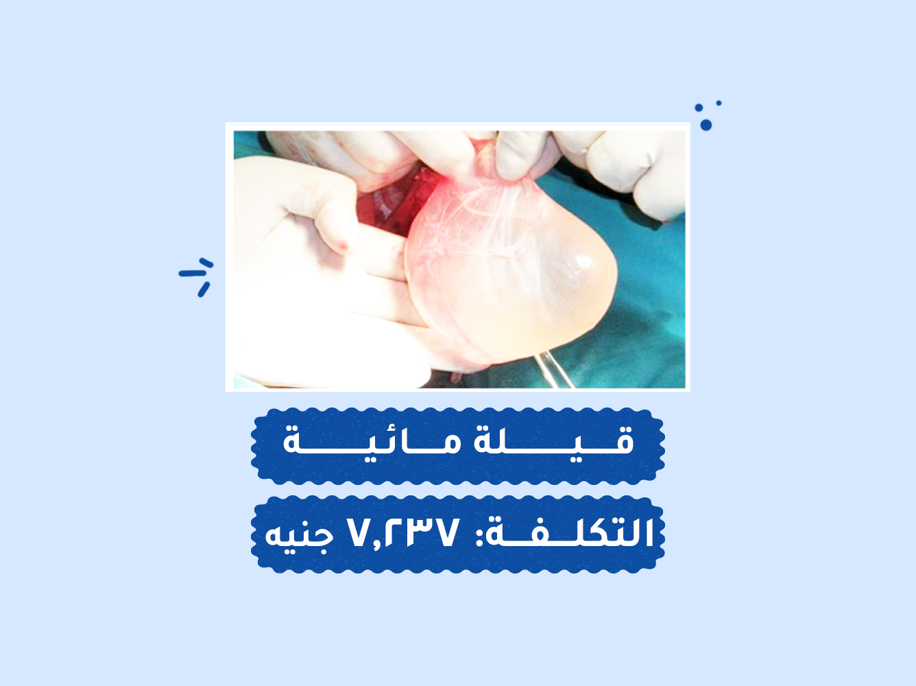 حالة رقم (93) عمليات