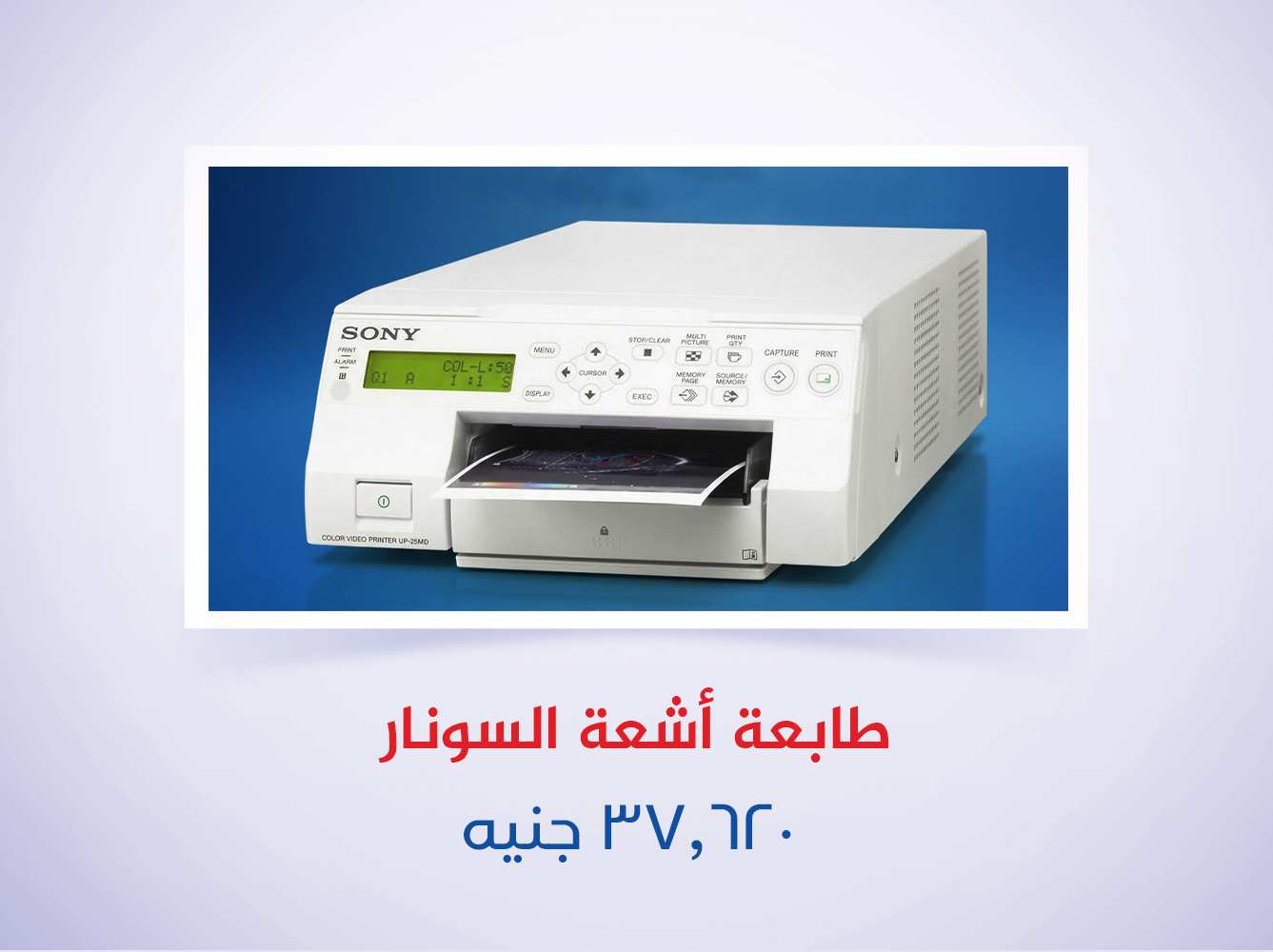 طابعة أشعة السونار